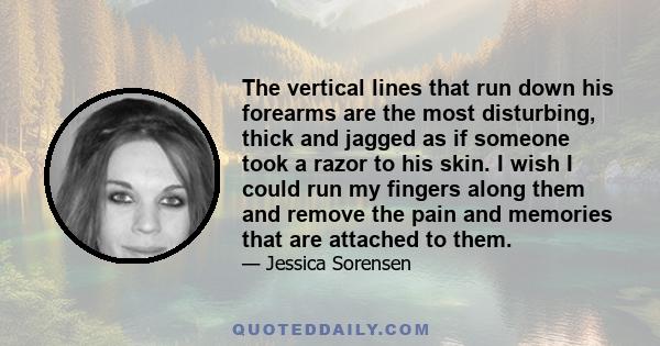The vertical lines that run down his forearms are the most disturbing, thick and jagged as if someone took a razor to his skin. I wish I could run my fingers along them and remove the pain and memories that are attached