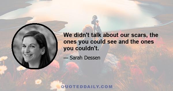 We didn't talk about our scars, the ones you could see and the ones you couldn't.