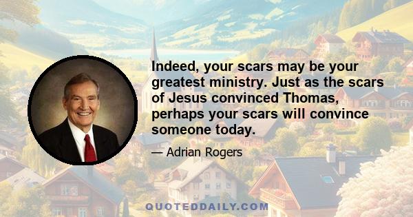 Indeed, your scars may be your greatest ministry. Just as the scars of Jesus convinced Thomas, perhaps your scars will convince someone today.