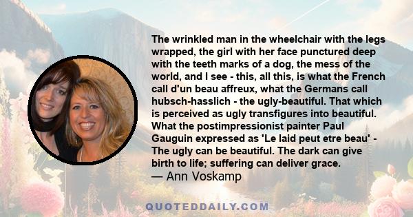 The wrinkled man in the wheelchair with the legs wrapped, the girl with her face punctured deep with the teeth marks of a dog, the mess of the world, and I see - this, all this, is what the French call d'un beau