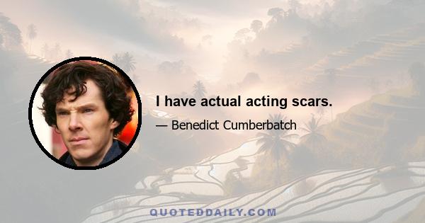 I have actual acting scars.