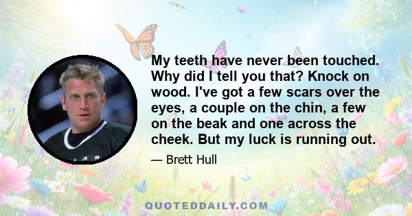 My teeth have never been touched. Why did I tell you that? Knock on wood. I've got a few scars over the eyes, a couple on the chin, a few on the beak and one across the cheek. But my luck is running out.