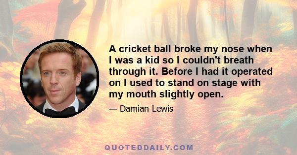 A cricket ball broke my nose when I was a kid so I couldn't breath through it. Before I had it operated on I used to stand on stage with my mouth slightly open.