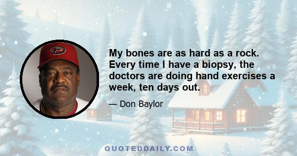 My bones are as hard as a rock. Every time I have a biopsy, the doctors are doing hand exercises a week, ten days out.