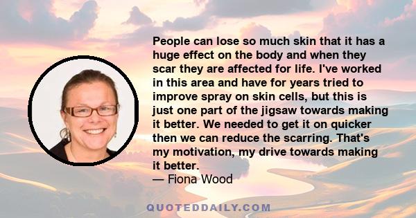 People can lose so much skin that it has a huge effect on the body and when they scar they are affected for life. I've worked in this area and have for years tried to improve spray on skin cells, but this is just one