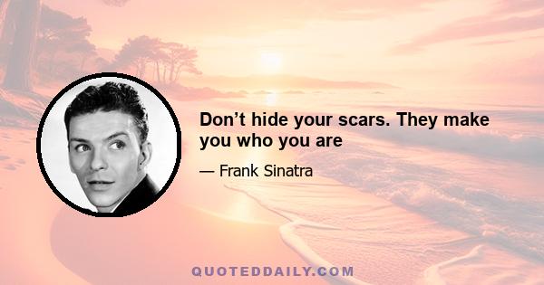 Don’t hide your scars. They make you who you are