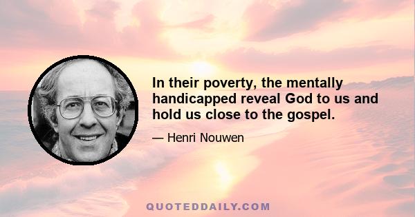 In their poverty, the mentally handicapped reveal God to us and hold us close to the gospel.