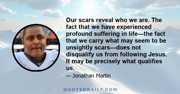 Our scars reveal who we are. The fact that we have experienced profound suffering in life—the fact that we carry what may seem to be unsightly scars—does not disqualify us from following Jesus. It may be precisely what