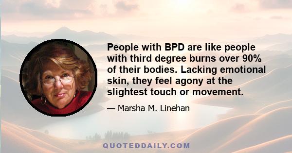 People with BPD are like people with third degree burns over 90% of their bodies. Lacking emotional skin, they feel agony at the slightest touch or movement.