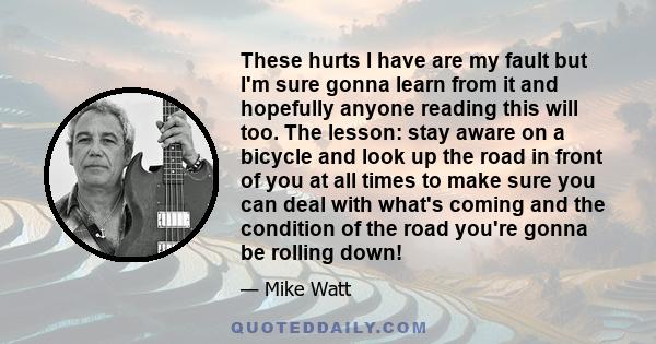 These hurts I have are my fault but I'm sure gonna learn from it and hopefully anyone reading this will too. The lesson: stay aware on a bicycle and look up the road in front of you at all times to make sure you can