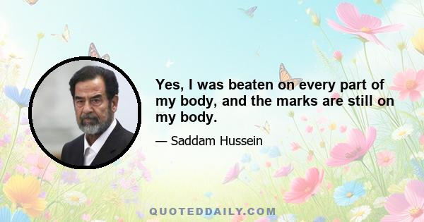 Yes, I was beaten on every part of my body, and the marks are still on my body.