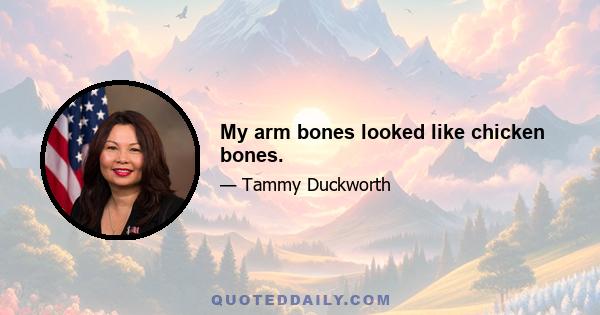 My arm bones looked like chicken bones.