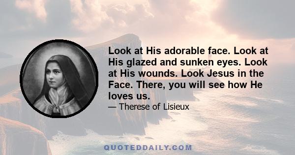 Look at His adorable face. Look at His glazed and sunken eyes. Look at His wounds. Look Jesus in the Face. There, you will see how He loves us.