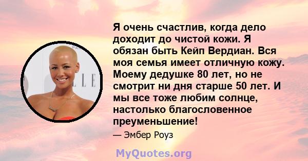 Я очень счастлив, когда дело доходит до чистой кожи. Я обязан быть Кейп Вердиан. Вся моя семья имеет отличную кожу. Моему дедушке 80 лет, но не смотрит ни дня старше 50 лет. И мы все тоже любим солнце, настолько