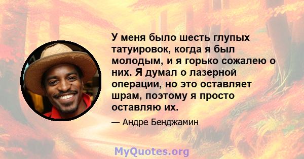 У меня было шесть глупых татуировок, когда я был молодым, и я горько сожалею о них. Я думал о лазерной операции, но это оставляет шрам, поэтому я просто оставляю их.