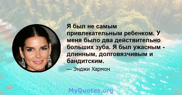 Я был не самым привлекательным ребенком. У меня было два действительно больших зуба. Я был ужасным - длинным, долговязчивым и бандитским.