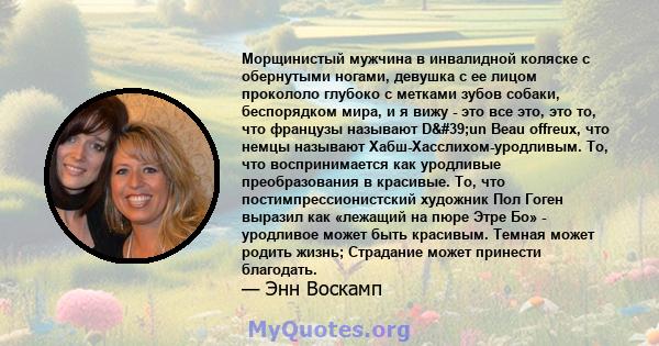 Морщинистый мужчина в инвалидной коляске с обернутыми ногами, девушка с ее лицом прокололо глубоко с метками зубов собаки, беспорядком мира, и я вижу - это все это, это то, что французы называют D'un Beau offreux,