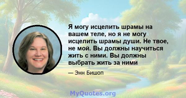 Я могу исцелить шрамы на вашем теле, но я не могу исцелить шрамы души. Не твое, не мой. Вы должны научиться жить с ними. Вы должны выбрать жить за ними