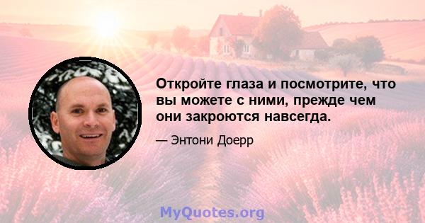 Откройте глаза и посмотрите, что вы можете с ними, прежде чем они закроются навсегда.