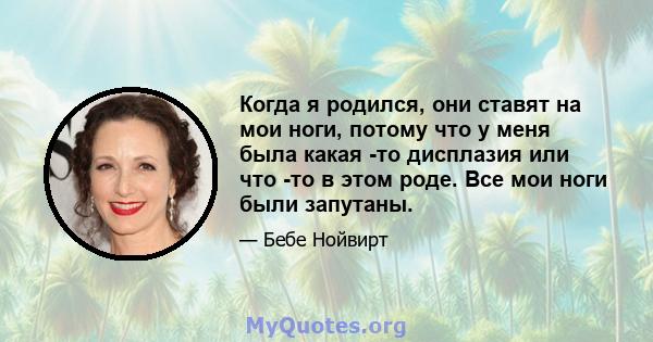 Когда я родился, они ставят на мои ноги, потому что у меня была какая -то дисплазия или что -то в этом роде. Все мои ноги были запутаны.