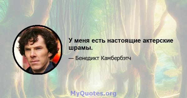 У меня есть настоящие актерские шрамы.