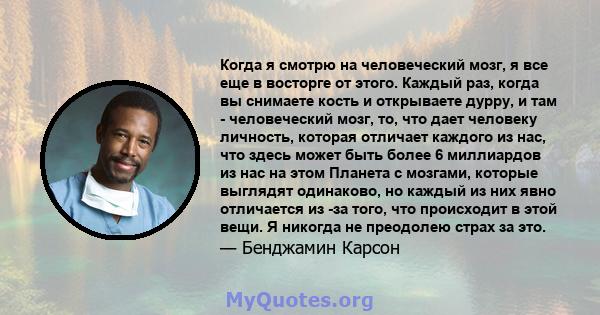 Когда я смотрю на человеческий мозг, я все еще в восторге от этого. Каждый раз, когда вы снимаете кость и открываете дурру, и там - человеческий мозг, то, что дает человеку личность, которая отличает каждого из нас, что 