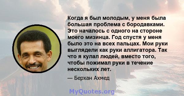 Когда я был молодым, у меня была большая проблема с бородавками. Это началось с одного на стороне моего мизинца. Год спустя у меня было это на всех пальцах. Мои руки выглядели как руки аллигатора. Так что я кулал людей, 