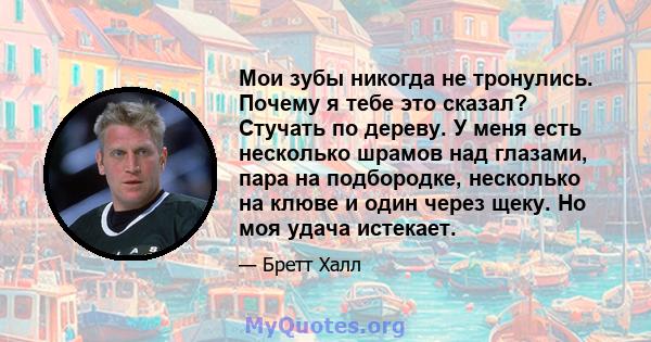 Мои зубы никогда не тронулись. Почему я тебе это сказал? Стучать по дереву. У меня есть несколько шрамов над глазами, пара на подбородке, несколько на клюве и один через щеку. Но моя удача истекает.