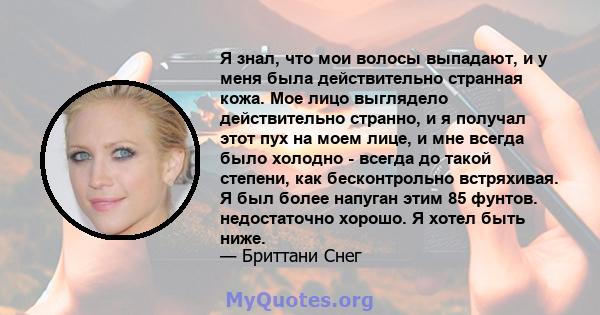 Я знал, что мои волосы выпадают, и у меня была действительно странная кожа. Мое лицо выглядело действительно странно, и я получал этот пух на моем лице, и мне всегда было холодно - всегда до такой степени, как