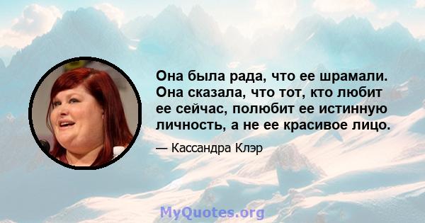 Она была рада, что ее шрамали. Она сказала, что тот, кто любит ее сейчас, полюбит ее истинную личность, а не ее красивое лицо.