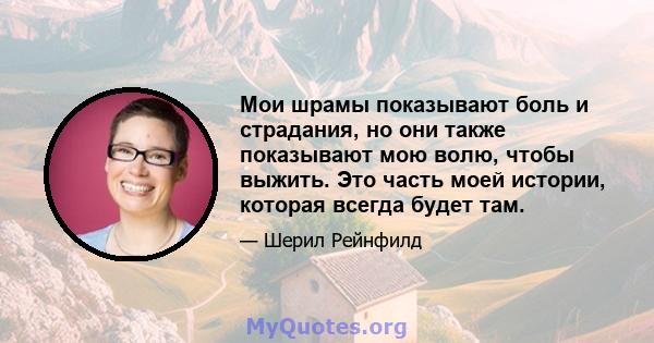 Мои шрамы показывают боль и страдания, но они также показывают мою волю, чтобы выжить. Это часть моей истории, которая всегда будет там.