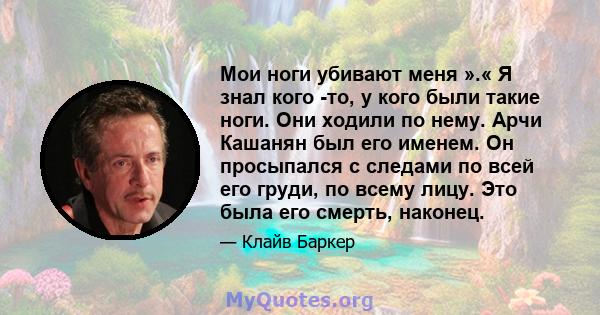 Мои ноги убивают меня ».« Я знал кого -то, у кого были такие ноги. Они ходили по нему. Арчи Кашанян был его именем. Он просыпался с следами по всей его груди, по всему лицу. Это была его смерть, наконец.