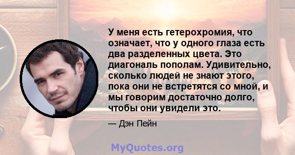 У меня есть гетерохромия, что означает, что у одного глаза есть два разделенных цвета. Это диагональ пополам. Удивительно, сколько людей не знают этого, пока они не встретятся со мной, и мы говорим достаточно долго,