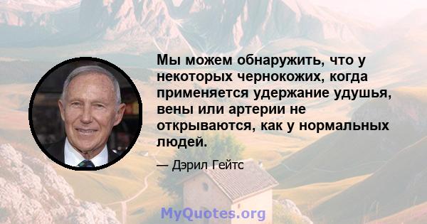 Мы можем обнаружить, что у некоторых чернокожих, когда применяется удержание удушья, вены или артерии не открываются, как у нормальных людей.