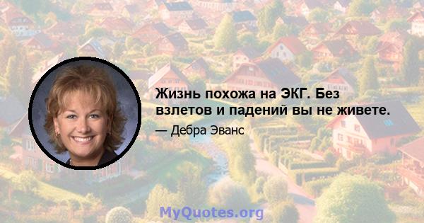 Жизнь похожа на ЭКГ. Без взлетов и падений вы не живете.