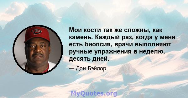 Мои кости так же сложны, как камень. Каждый раз, когда у меня есть биопсия, врачи выполняют ручные упражнения в неделю, десять дней.