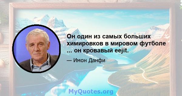 Он один из самых больших химировков в мировом футболе ... он кровавый eejit.