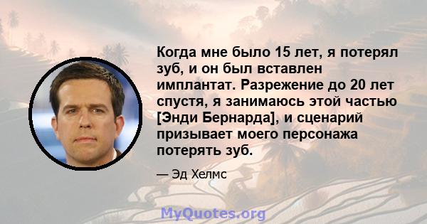 Когда мне было 15 лет, я потерял зуб, и он был вставлен имплантат. Разрежение до 20 лет спустя, я занимаюсь этой частью [Энди Бернарда], и сценарий призывает моего персонажа потерять зуб.