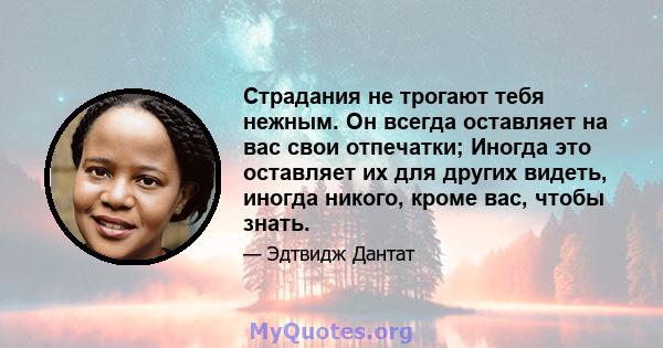 Страдания не трогают тебя нежным. Он всегда оставляет на вас свои отпечатки; Иногда это оставляет их для других видеть, иногда никого, кроме вас, чтобы знать.