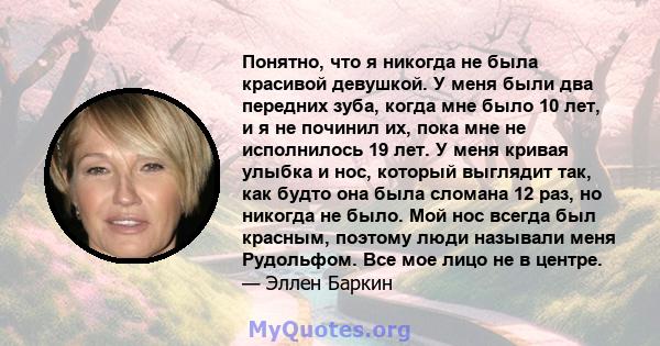 Понятно, что я никогда не была красивой девушкой. У меня были два передних зуба, когда мне было 10 лет, и я не починил их, пока мне не исполнилось 19 лет. У меня кривая улыбка и нос, который выглядит так, как будто она