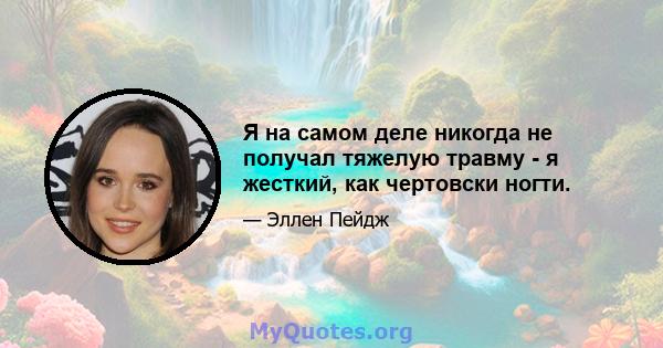 Я на самом деле никогда не получал тяжелую травму - я жесткий, как чертовски ногти.