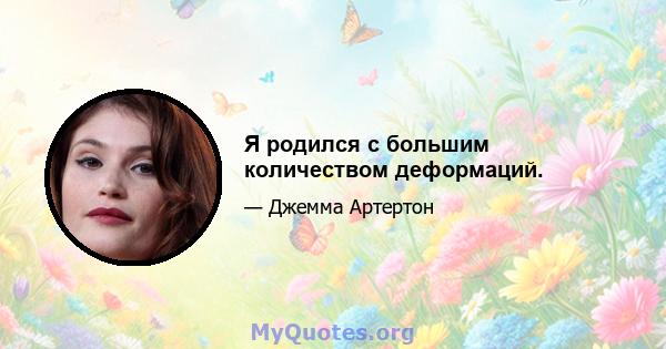 Я родился с большим количеством деформаций.