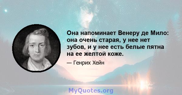 Она напоминает Венеру де Мило: она очень старая, у нее нет зубов, и у нее есть белые пятна на ее желтой коже.