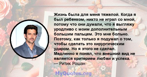 Жизнь была для меня тяжелой. Когда я был ребенком, никто не играл со мной, потому что они думали, что я выгляжу уродливо с моим дополнительным большим пальцем. Это мне больно. Поэтому, как только я подумал о том, чтобы