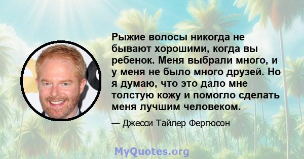 Рыжие волосы никогда не бывают хорошими, когда вы ребенок. Меня выбрали много, и у меня не было много друзей. Но я думаю, что это дало мне толстую кожу и помогло сделать меня лучшим человеком.