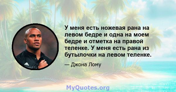 У меня есть ножевая рана на левом бедре и одна на моем бедре и отметка на правой теленке. У меня есть рана из бутылочки на левом теленке.