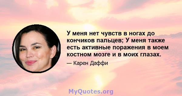 У меня нет чувств в ногах до кончиков пальцев; У меня также есть активные поражения в моем костном мозге и в моих глазах.