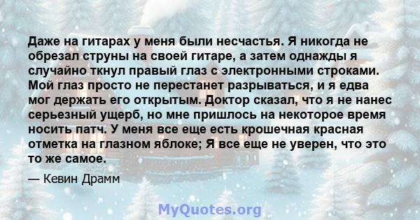 Даже на гитарах у меня были несчастья. Я никогда не обрезал струны на своей гитаре, а затем однажды я случайно ткнул правый глаз с электронными строками. Мой глаз просто не перестанет разрываться, и я едва мог держать