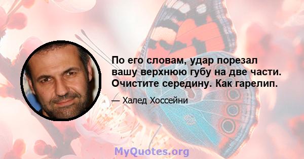 По его словам, удар порезал вашу верхнюю губу на две части. Очистите середину. Как гарелип.