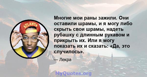 Многие мои раны зажили. Они оставили шрамы, и я могу либо скрыть свои шрамы, надеть рубашку с длинным рукавом и прикрыть их. Или я могу показать их и сказать: «Да, это случилось».